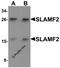 CD48 Molecule antibody, 6249, ProSci, Western Blot image 