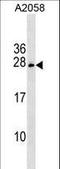 Coiled-Coil-Helix-Coiled-Coil-Helix Domain Containing 6 antibody, LS-C159343, Lifespan Biosciences, Western Blot image 