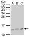 Late Endosomal/Lysosomal Adaptor, MAPK And MTOR Activator 3 antibody, GTX111032, GeneTex, Western Blot image 