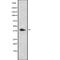 Galanin Receptor 3 antibody, abx215535, Abbexa, Western Blot image 