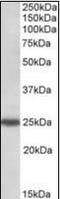 Rho GDP Dissociation Inhibitor Gamma antibody, orb96441, Biorbyt, Western Blot image 