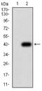 Keratin 10 antibody, NBP2-61736, Novus Biologicals, Western Blot image 