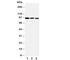 Aryl Hydrocarbon Receptor antibody, R30877, NSJ Bioreagents, Western Blot image 