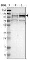 Transmembrane And Tetratricopeptide Repeat Containing 1 antibody, NBP1-88837, Novus Biologicals, Western Blot image 