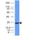 Immunoglobulin Kappa Variable 1D-16 antibody, NBP2-45079, Novus Biologicals, Western Blot image 