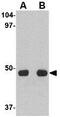 Unc-93 Homolog A antibody, GTX31964, GeneTex, Western Blot image 