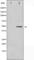 Glycogen Synthase Kinase 3 Alpha antibody, abx010871, Abbexa, Western Blot image 