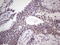 Basic Helix-Loop-Helix Family Member E41 antibody, LS-C339849, Lifespan Biosciences, Immunohistochemistry paraffin image 