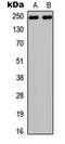 Notch Receptor 3 antibody, orb234926, Biorbyt, Western Blot image 