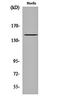 c-met antibody, orb159573, Biorbyt, Western Blot image 