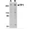 Telomerase Associated Protein 1 antibody, MBS150989, MyBioSource, Western Blot image 