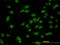 Distal-Less Homeobox 1 antibody, LS-C197056, Lifespan Biosciences, Immunofluorescence image 