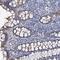 Core-Binding Factor Subunit Beta antibody, NBP1-87300, Novus Biologicals, Immunohistochemistry frozen image 