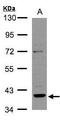 DNA repair protein RAD51 homolog 2 antibody, GTX106045, GeneTex, Western Blot image 