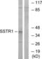 Somatostatin Receptor 1 antibody, LS-C120951, Lifespan Biosciences, Western Blot image 