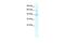 Potassium Channel Tetramerization Domain Containing 10 antibody, GTX47648, GeneTex, Western Blot image 