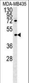 Pyrin And HIN Domain Family Member 1 antibody, LS-C162341, Lifespan Biosciences, Western Blot image 