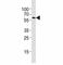 Autophagy Related 5 antibody, F53381-0.4ML, NSJ Bioreagents, Western Blot image 