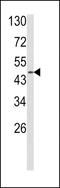 Adrenoceptor Alpha 2B antibody, GTX81169, GeneTex, Western Blot image 