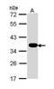 ATPase Na+/K+ Transporting Subunit Beta 1 antibody, PA5-29719, Invitrogen Antibodies, Western Blot image 