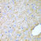 Inhibin Subunit Alpha antibody, A02413-1, Boster Biological Technology, Immunohistochemistry paraffin image 