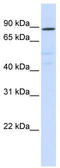 V-type proton ATPase 116 kDa subunit a isoform 2 antibody, TA346466, Origene, Western Blot image 
