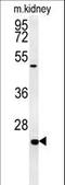 Shisa Family Member 2 antibody, LS-C161074, Lifespan Biosciences, Western Blot image 