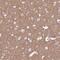 Adducin 2 antibody, NBP2-33975, Novus Biologicals, Immunohistochemistry paraffin image 