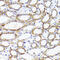 Suppressor Of Cytokine Signaling 3 antibody, 13-252, ProSci, Immunohistochemistry paraffin image 