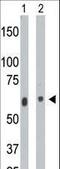 Ceramide kinase antibody, LS-B9627, Lifespan Biosciences, Western Blot image 