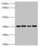 Pyridoxal Kinase antibody, LS-C676240, Lifespan Biosciences, Western Blot image 