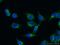 ABCD1 antibody, 60153-1-Ig, Proteintech Group, Immunofluorescence image 