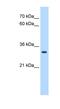 Developing Brain Homeobox 2 antibody, NBP1-79212, Novus Biologicals, Western Blot image 