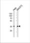 NF-kappa-B inhibitor alpha antibody, TA325169, Origene, Western Blot image 