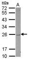 Dual Specificity Phosphatase 22 antibody, GTX112048, GeneTex, Western Blot image 