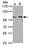 DEAD-Box Helicase 23 antibody, GTX115235, GeneTex, Western Blot image 