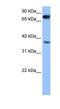 Zinc Finger CCHC-Type Containing 12 antibody, NBP1-54808, Novus Biologicals, Western Blot image 