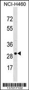 Voltage Dependent Anion Channel 3 antibody, 58-941, ProSci, Western Blot image 
