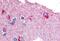 Glycogen Phosphorylase B antibody, MBS240043, MyBioSource, Immunohistochemistry paraffin image 
