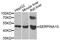 Serpin Family A Member 10 antibody, STJ29186, St John