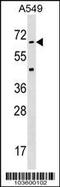 Serine/threonine-protein kinase 35 antibody, 62-756, ProSci, Western Blot image 