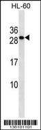 Transmembrane P24 Trafficking Protein 6 antibody, 58-608, ProSci, Western Blot image 