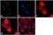 Protein Tyrosine Kinase 2 antibody, GTX24804, GeneTex, Immunocytochemistry image 