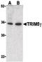 Tripartite Motif Containing 5 antibody, PA5-20047, Invitrogen Antibodies, Western Blot image 