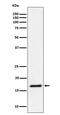 Ubiquitin Conjugating Enzyme E2 L3 antibody, M01832, Boster Biological Technology, Western Blot image 