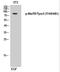 MER Proto-Oncogene, Tyrosine Kinase antibody, PA5-40270, Invitrogen Antibodies, Western Blot image 