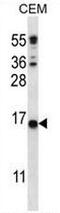 Transmembrane Protein 254 antibody, AP50929PU-N, Origene, Western Blot image 