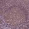 PEAK1 Related, Kinase-Activating Pseudokinase 1 antibody, NBP1-87473, Novus Biologicals, Immunohistochemistry paraffin image 