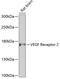 Kinase Insert Domain Receptor antibody, 23-114, ProSci, Western Blot image 