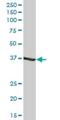 Alcohol Dehydrogenase 1C (Class I), Gamma Polypeptide antibody, H00000126-B01P, Novus Biologicals, Western Blot image 